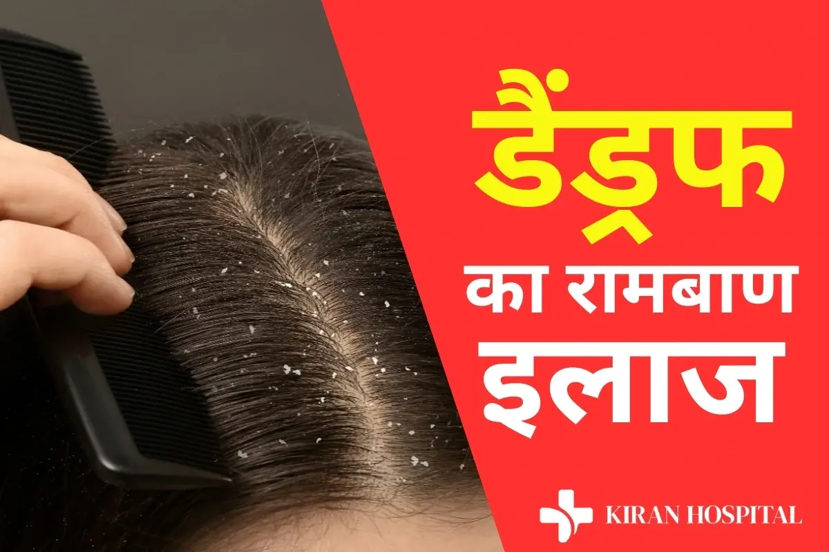 Dandruff Blog Image