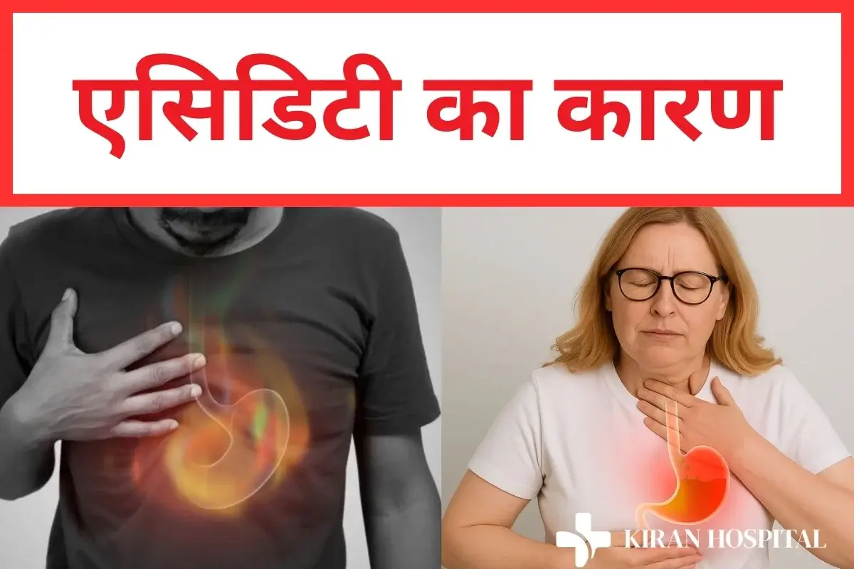 एसिडिटी का कारण
