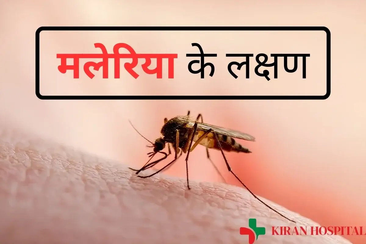 मलेरिया के लक्षण