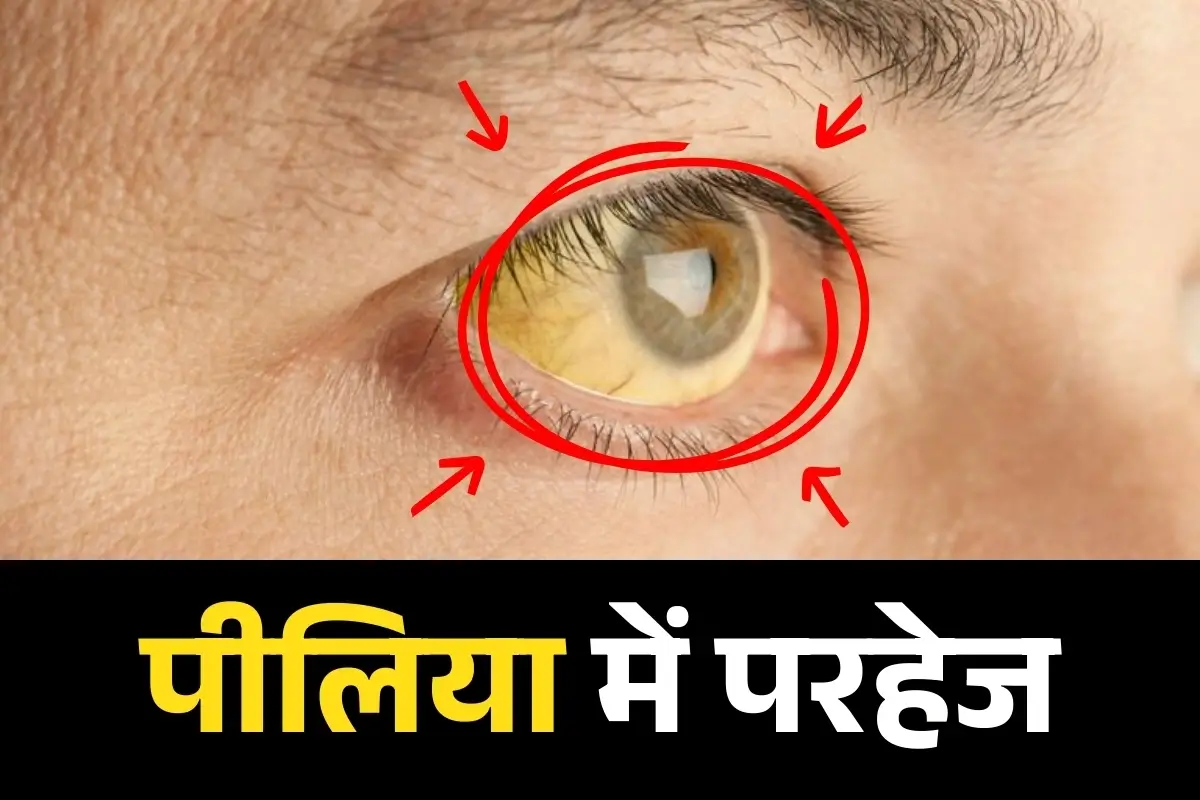 Peelia Parhej Blog Image