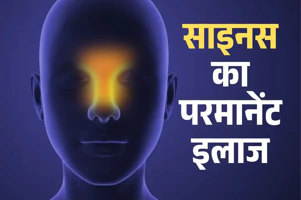साइनस का परमानेंट इलाज: कारण, लक्षण और घरेलू उपाय