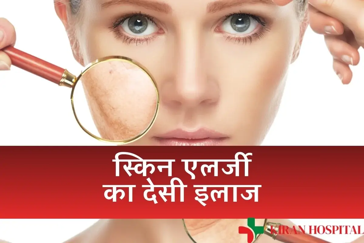 Skin Allergy Home Remedies Blog Image