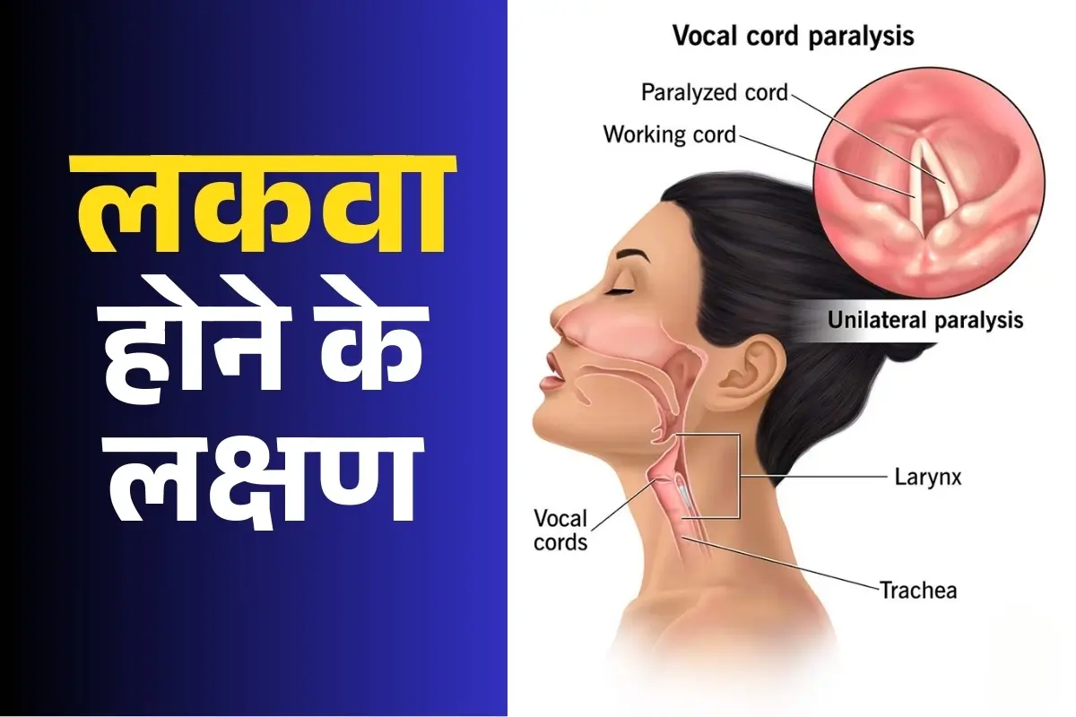 Symptoms Of Paralysis Blog Image